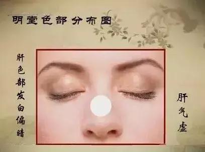 中医望诊鼻子发青,受凉鼻根发青是什么原因