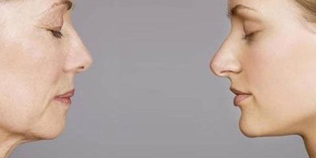 欧赛媤水光针怎么样,欧赛媤去黑眼圈效果维持多久