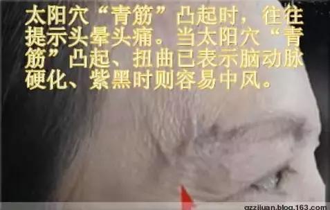 青筋的手诊方法,全身青筋诊病全集