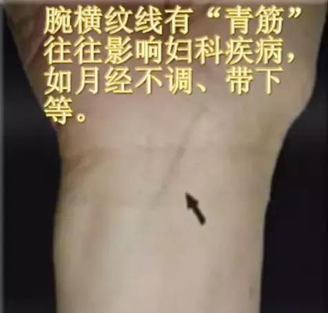 青筋的手诊方法,全身青筋诊病全集
