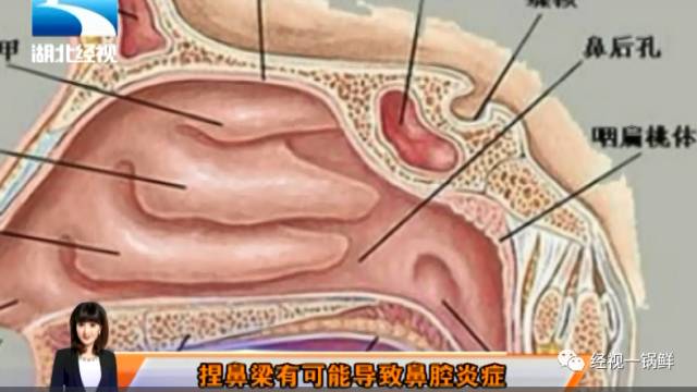 孙俪是怎么变高鼻梁的,孙俪高鼻梁怎么变挺