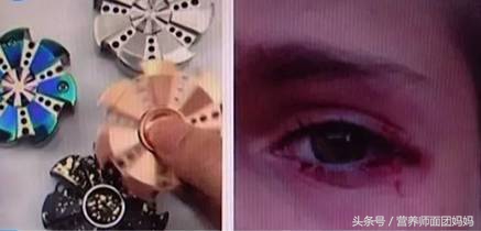 家长注意!火遍全球的指尖陀螺有危险!已经伤人,慎玩!