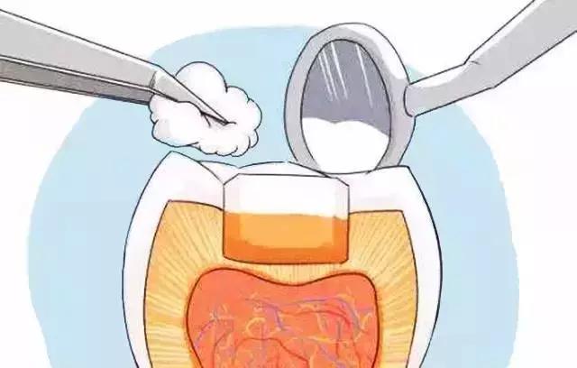 补牙怎么补性价比最高,省口腔医院补牙价格表