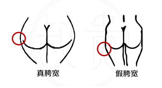 胯宽怎么办教程视频,改善假胯宽最有效的动作