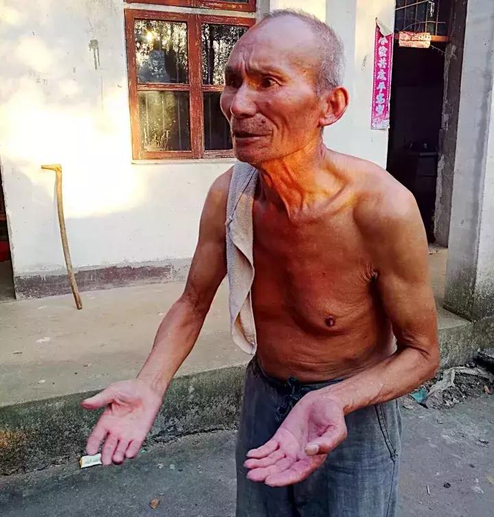 12岁男生突发糖尿病去哪家医院治,14岁男孩得了糖尿病怎么办