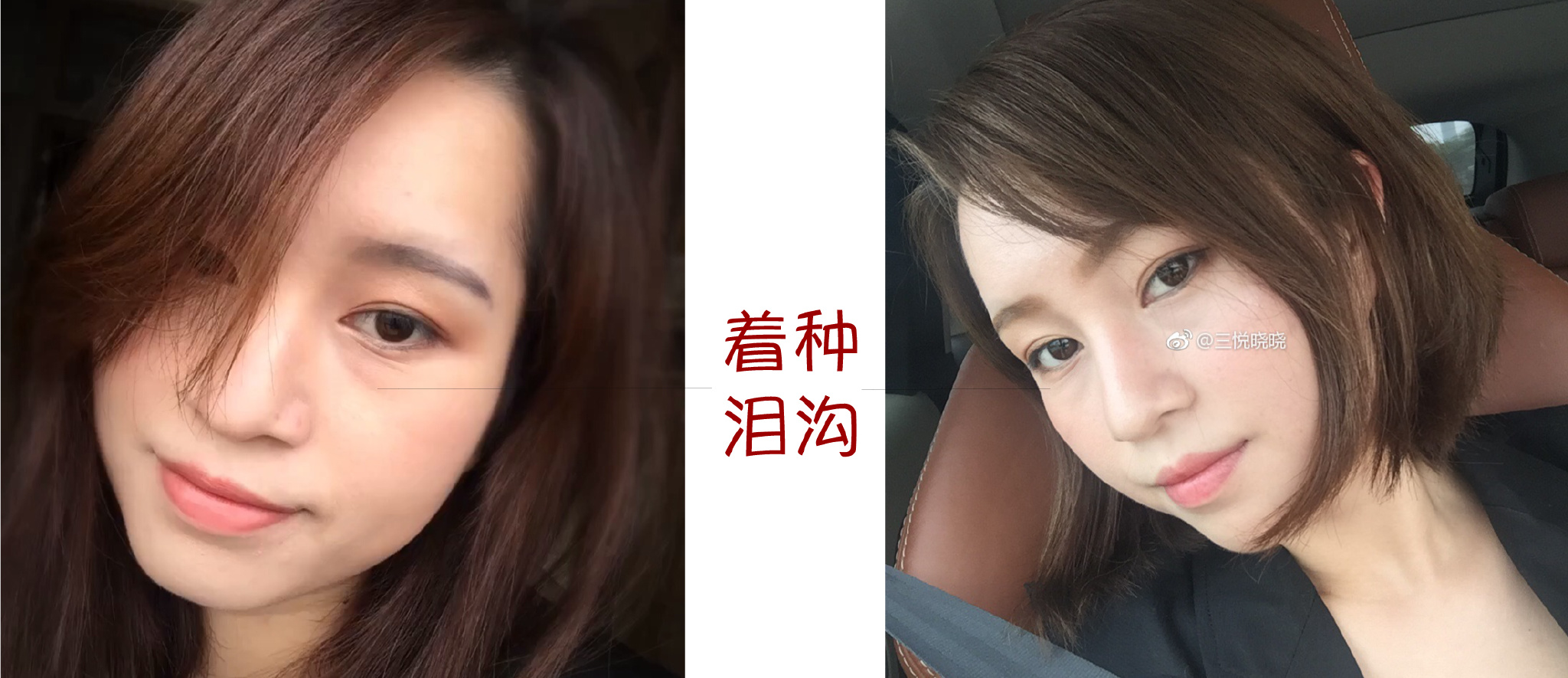 女大学生泪沟黑眼圈用什么眼霜,眼霜能去脂肪粒吗