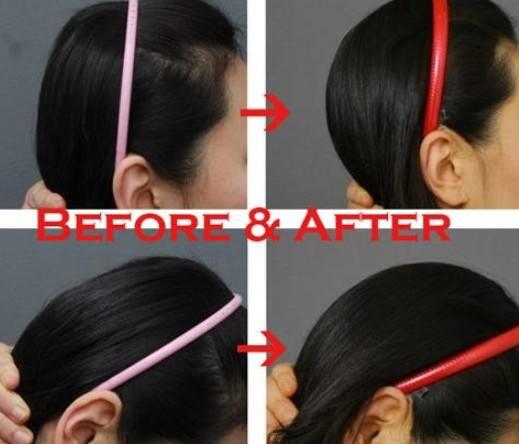 后脑勺凸起头型不好看如何矫正,什么头型让后脑勺凸起来