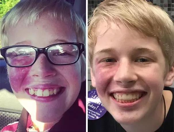 后悔整牙和不后悔整牙,整牙一般整到什么样就可以了