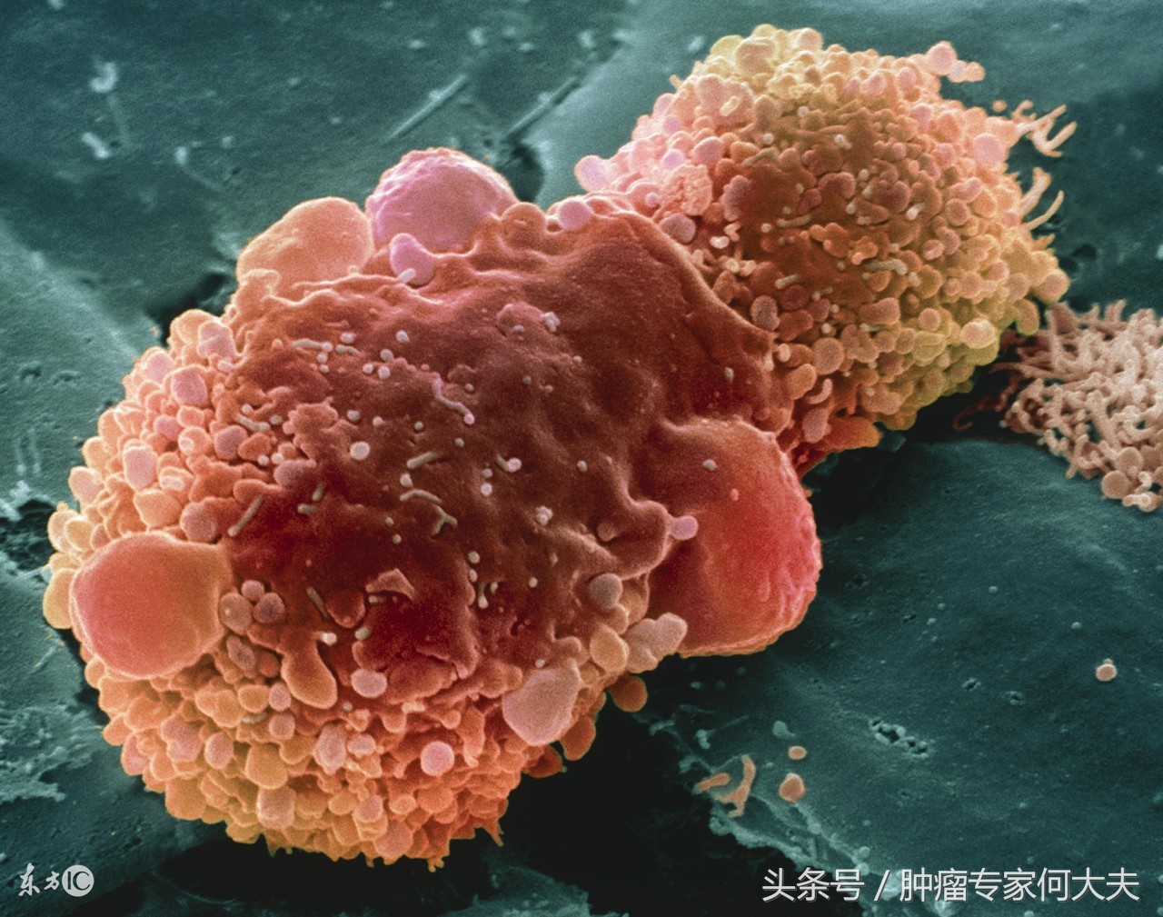 肺癌免疫治疗药物有副作用吗,肺癌免疫疗法副作用