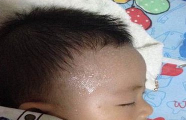 宝宝缺少铁的症状,宝宝缺少钙和维生素的表现