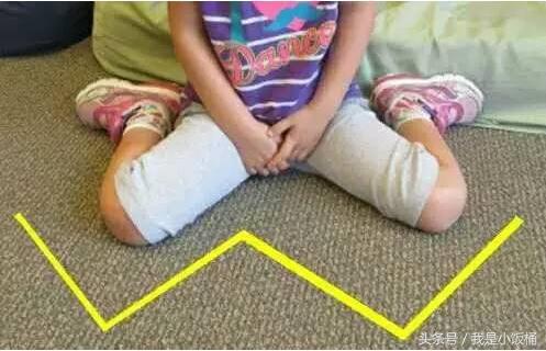 不想宝宝变成八字脚o型脚就千万不要这样做
