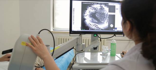 皮肤病检查报告单图片,皮肤科照妖镜