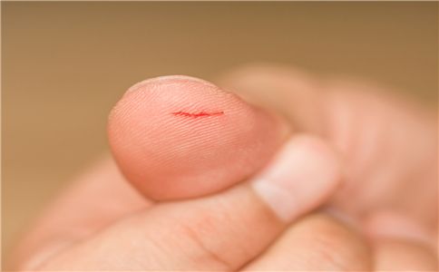 伤口旁边有一圈白色的是什么,伤口上面有白色的一层是什么