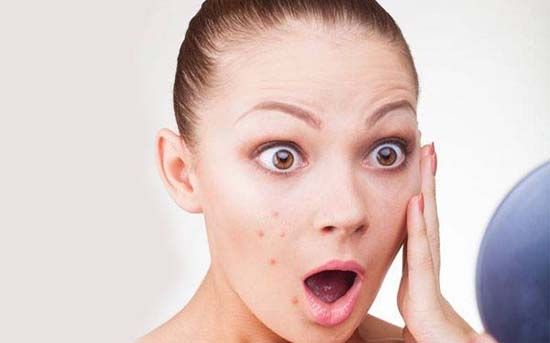 痘痘是紫色的怎么回事,脸上痘痘变成紫色的像是淤血一样
