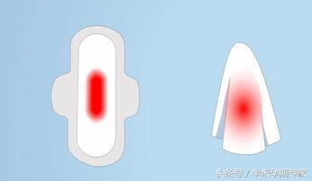 剖宫产个案护理模板,怎样护理剖宫产妈妈