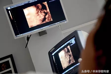 产后42天检查，到底查什么？