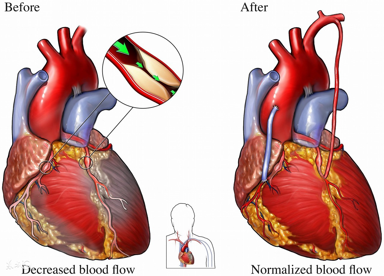 胸口有时候会一瞬间的疼,胸口有时闷一下心跳就快