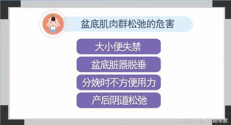 什么是凯格尔运动正确做法视频,什么是凯格尔运动男性
