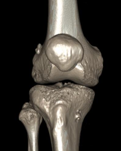 慢跑膝盖疼的恢复方法,慢跑为什么膝盖会疼