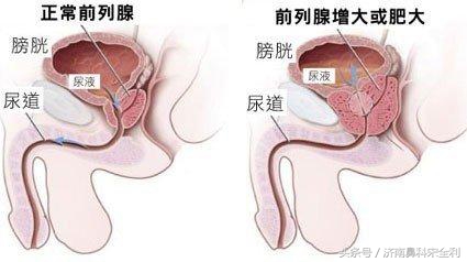 大病先兆自查表全文,大病先兆自查表格