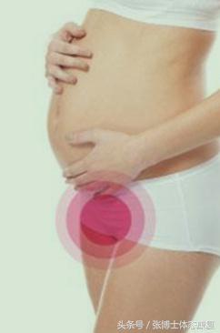 运动耻骨痛吃什么药,孕期运动操缓解盆骨疼