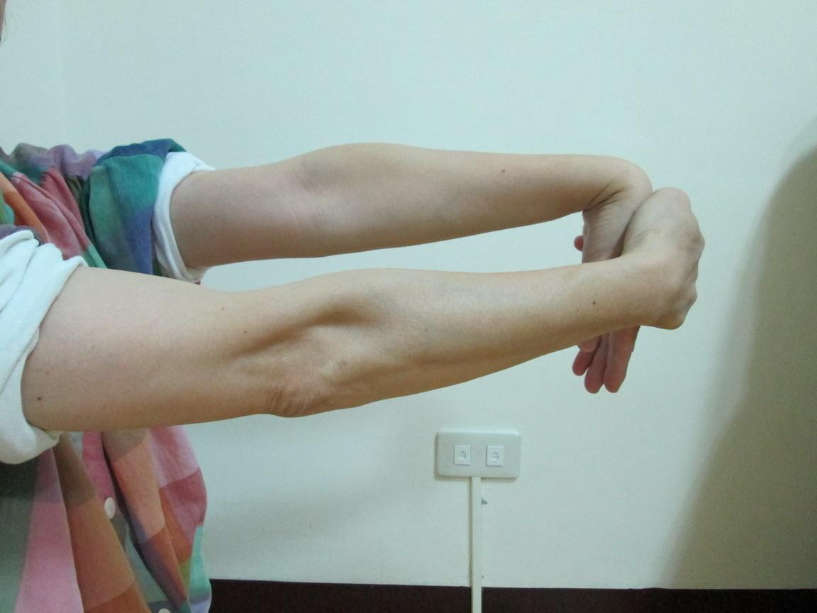 洗衣服拖地后腰疼怎么回事,洗衣服手臂肌肉酸痛