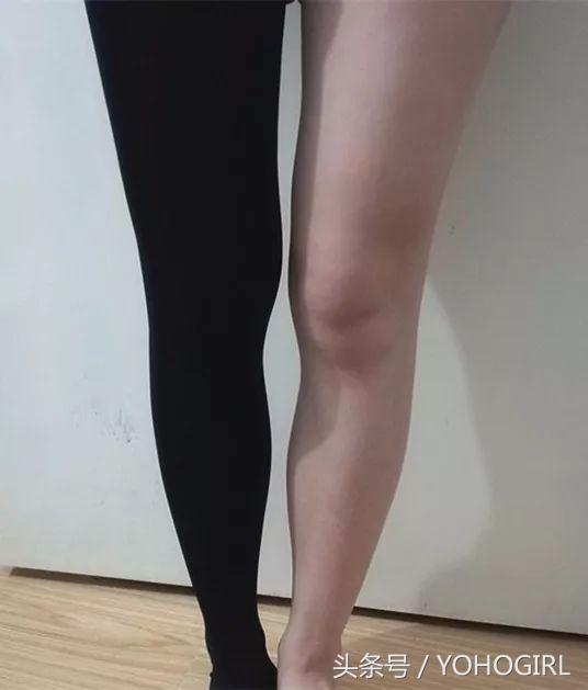 长期穿瘦腿袜会瘦腿吗,瘦腿袜真的可以瘦腿吗