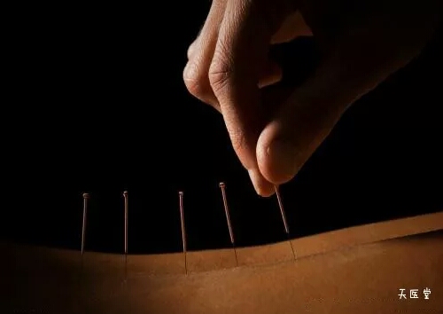 董氏针灸驷马穴取穴视频,董氏针灸什么穴位好