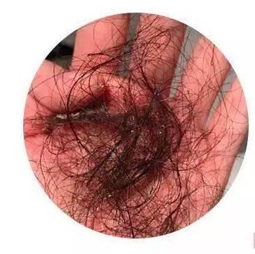 头发越掉越多？梳一梳就长回来了，你信不信！