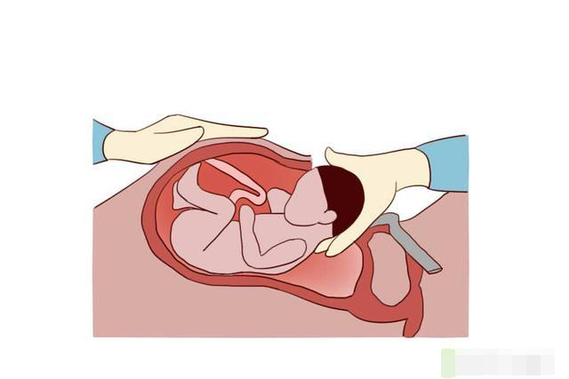 女人一生能承受多少次药物流产,女人一生能承受几次流产