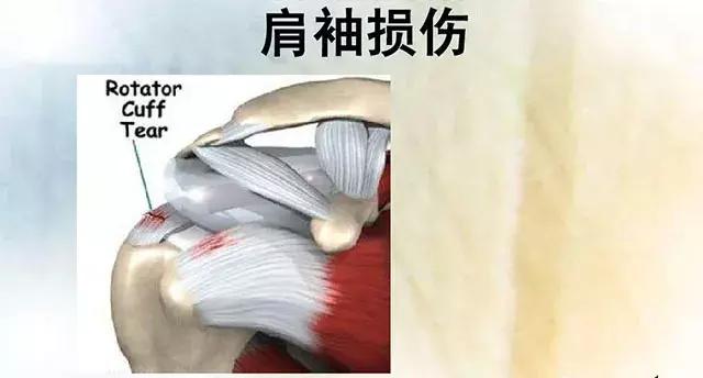 肩疼膀子疼去医院挂什么科,颈椎疼和肩疼会引起其它什么病