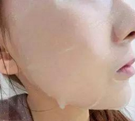 孕妇皮肤变差如何护肤,怀孕期多护肤皮肤是不是会变好