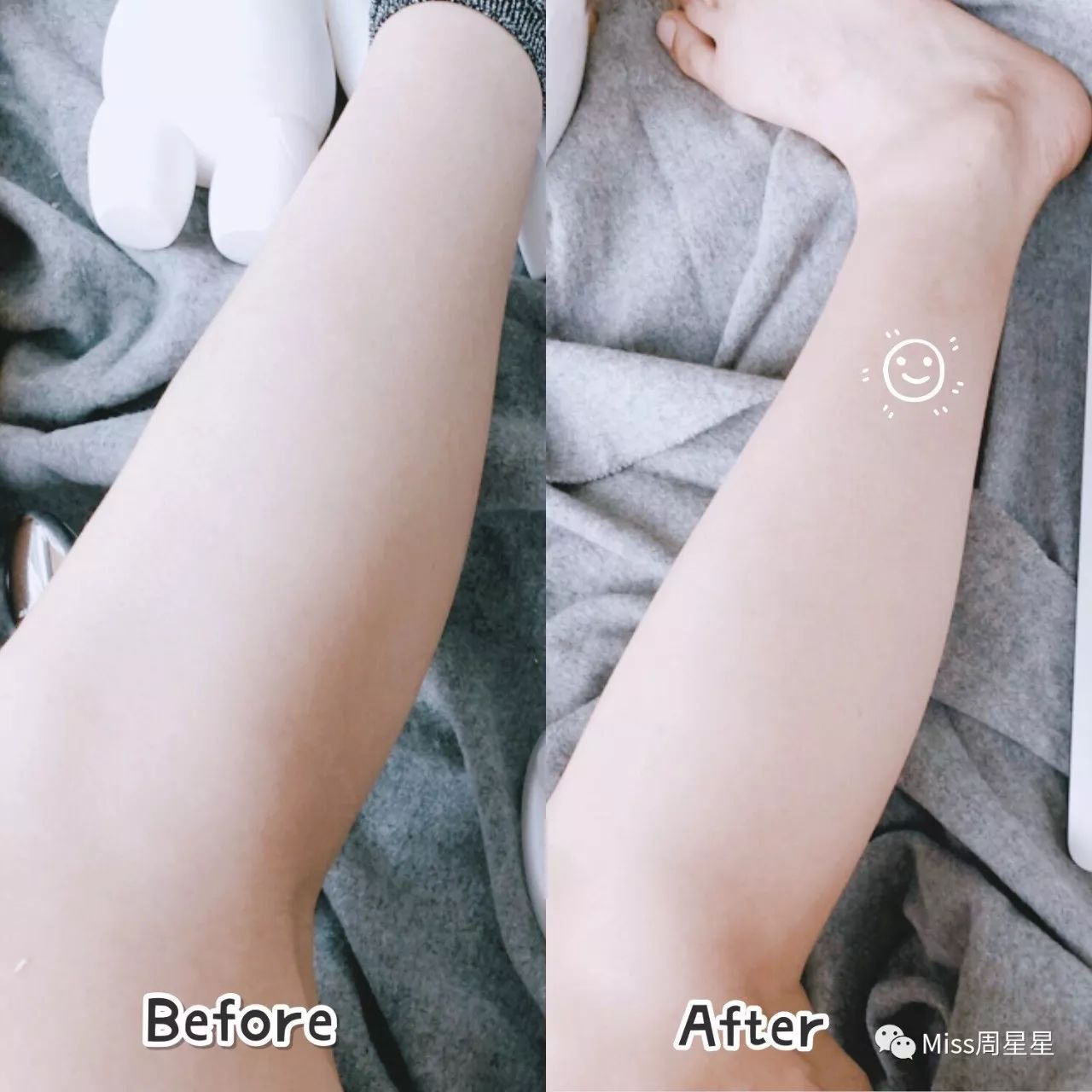 wellbox美容仪使用期限,万能美容仪wellbox