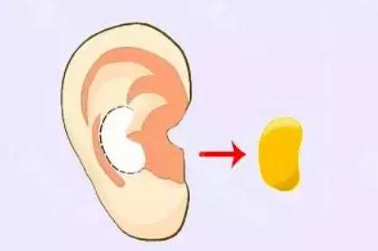 假体隆鼻都有什么术式,假体隆鼻一般用什么材料