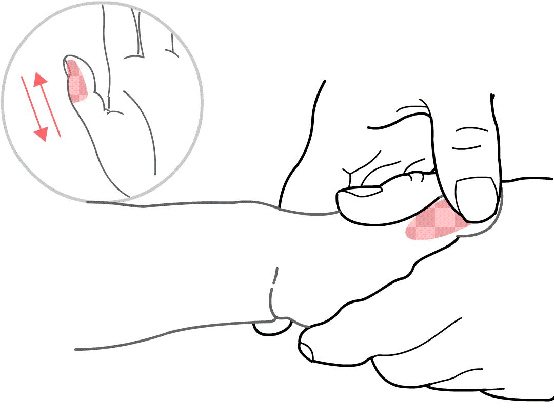 腺样体肥大和扁桃体肿大要手术吗,扁桃体肿大激光好还是手术割了好