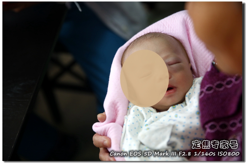 头皮癣治疗要多少钱,治疗头皮型银屑病需要多少钱