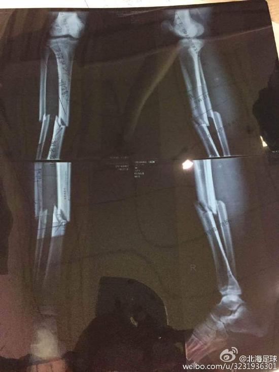 如此*力暴**的中国足球，我们凭什么相信明天会更好？