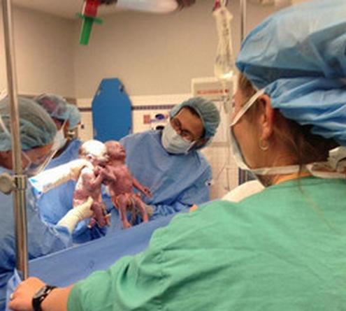 惊！宝妈这些技巧怀上“双胞胎”分享给大家