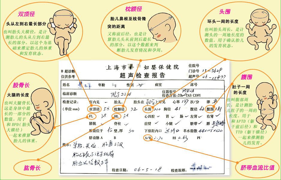 怎么看懂宝宝b超单,教你看懂b超回声