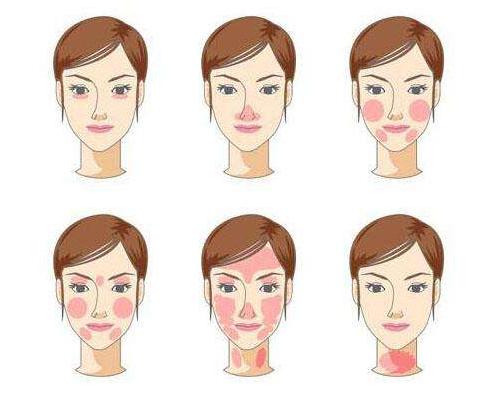 怎样改善面部红血丝肤质,脸部红血丝怎么修复医美