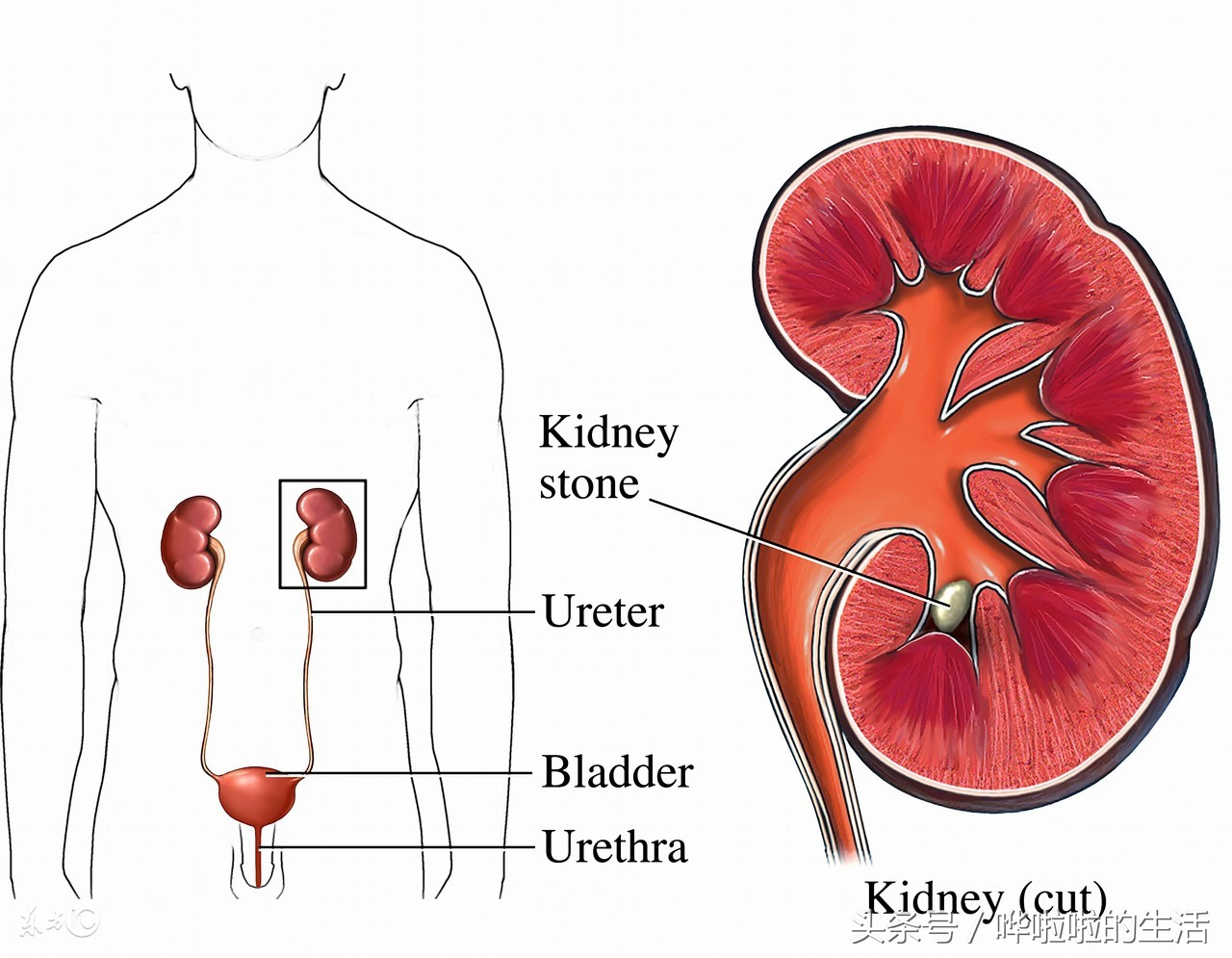 补钙过量过几天恢复正常钙量,过量补钙对身体有什么危害