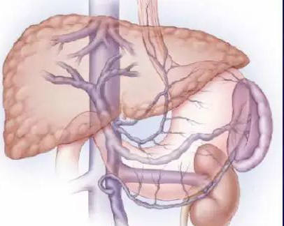 当心肝硬化晚期并发症！大吐血！附防治方案