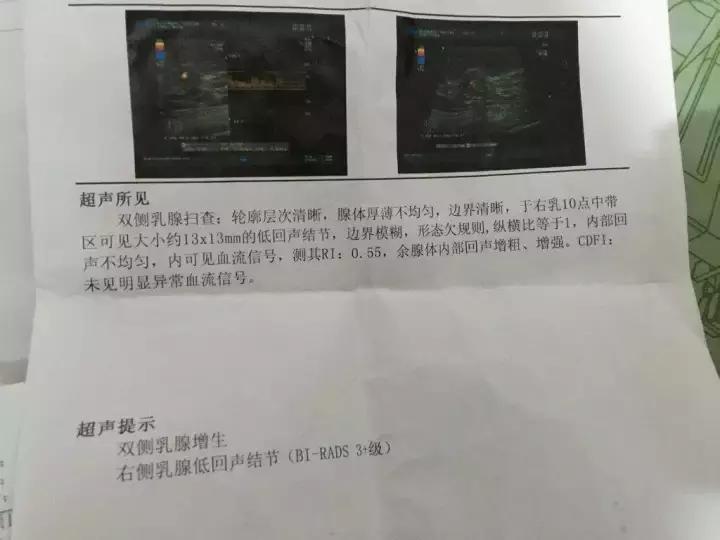 彩超的报告单结果是医生手打的吗,在医院做彩超报告是黑白的正常吗