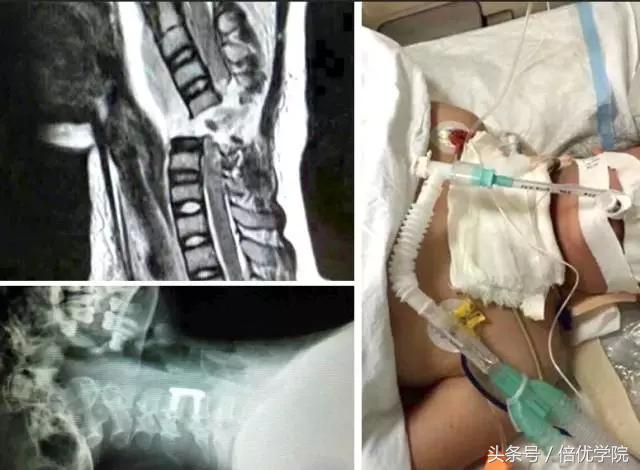 围巾怎样防止起球,围巾怎么防止落灰