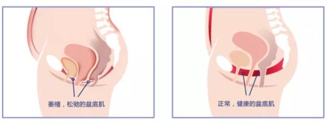 孕妈的肚子迅速变大,孕妈肚子怎么变大