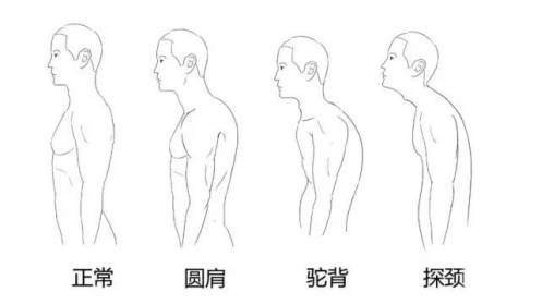 脖子左右摆动咔咔响怎么回事,脖子一转咔咔响