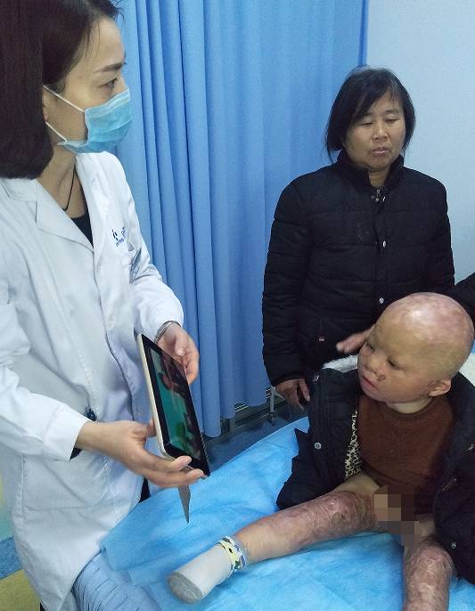 不忘初欣,奕起守护|9958「奕起祛疤童爱救助基金」救助进行中