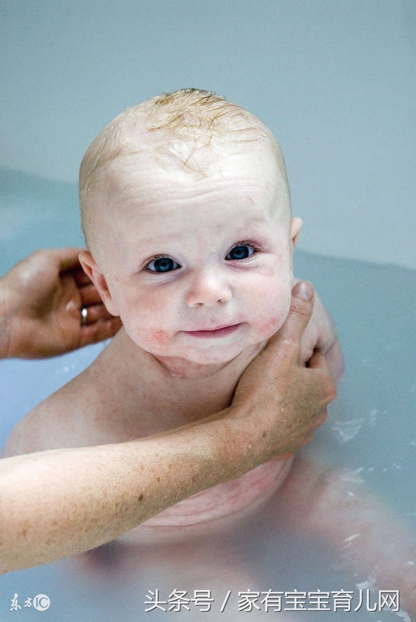 宝宝湿疹怎么预防和处理,冬季婴幼儿湿疹高发这几招最管用
