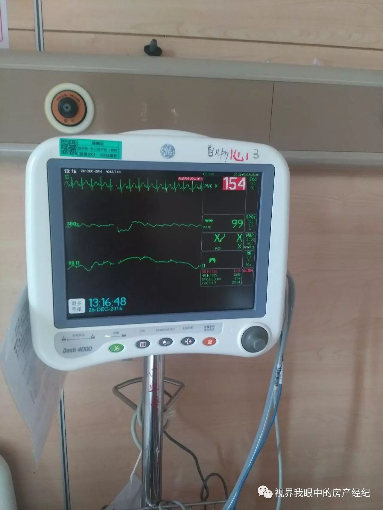 川崎病恢复期怎么预防感冒,川崎病当成感冒会出什么问题