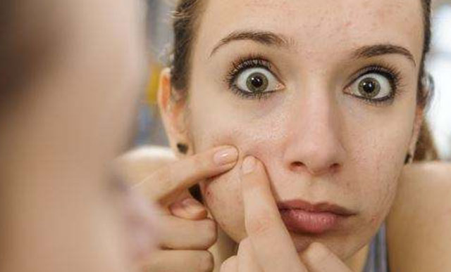 青春痘有什么方法解决,青春期已经长痘了怎么改善皮肤